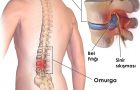 Bel Fıtığı Tedavi Yöntemleri